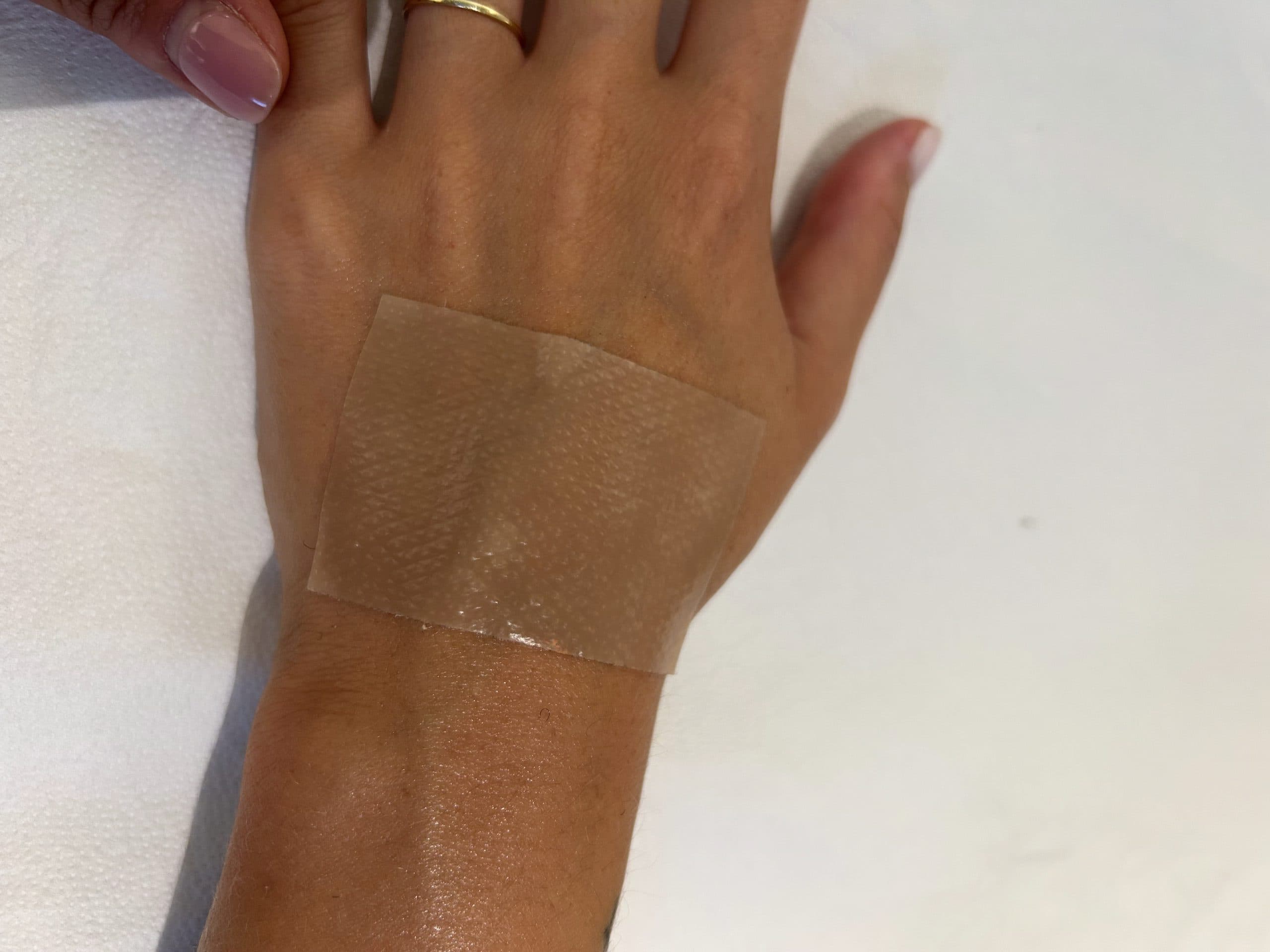 Scar Sheets silicone patches