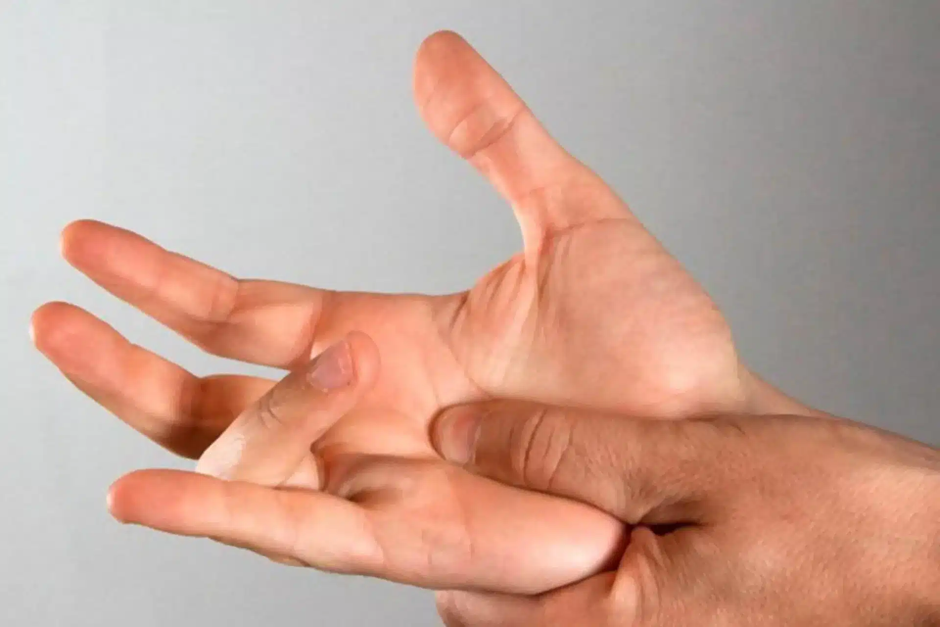 Trigger Finger: symptoms, causes, stages and treatment