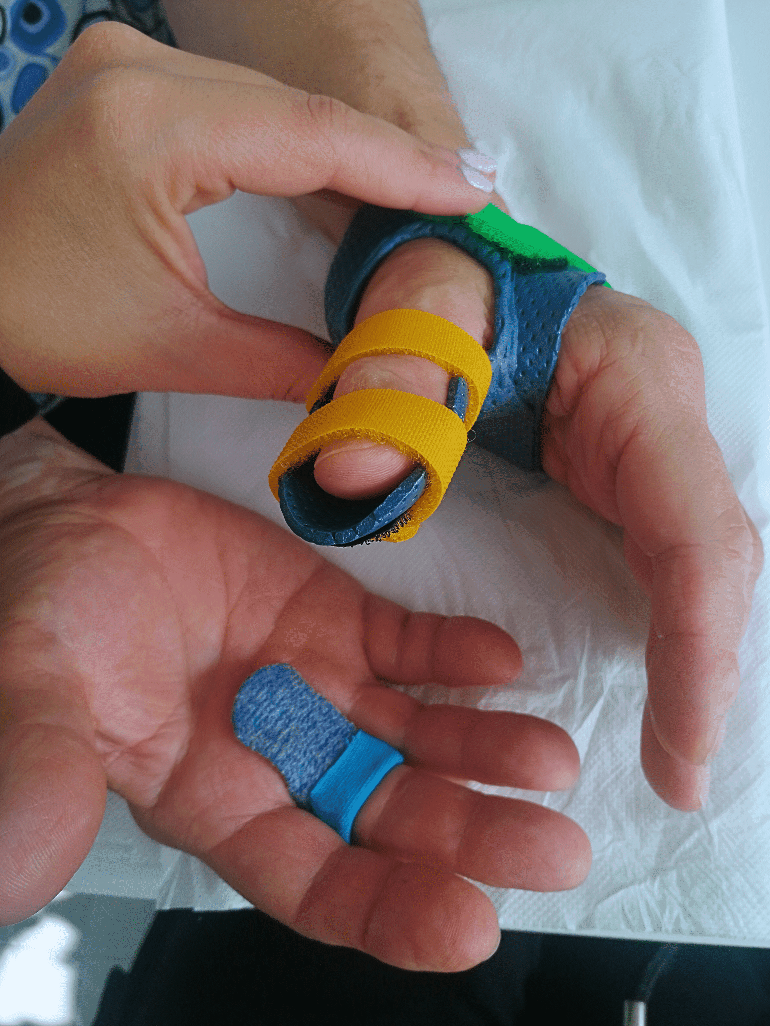 Specialist wrist & hand physiotherapy