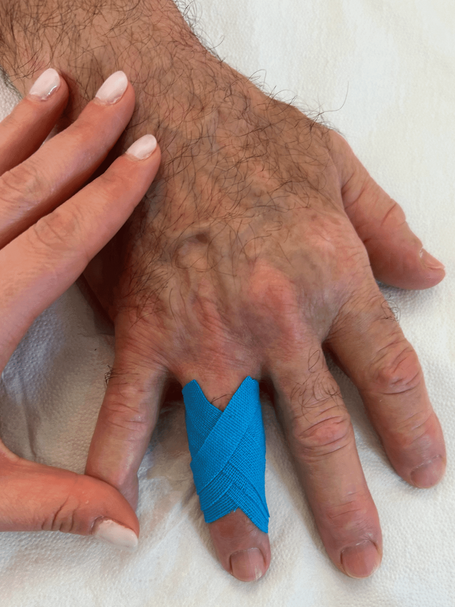 Specialist wrist & hand physiotherapy