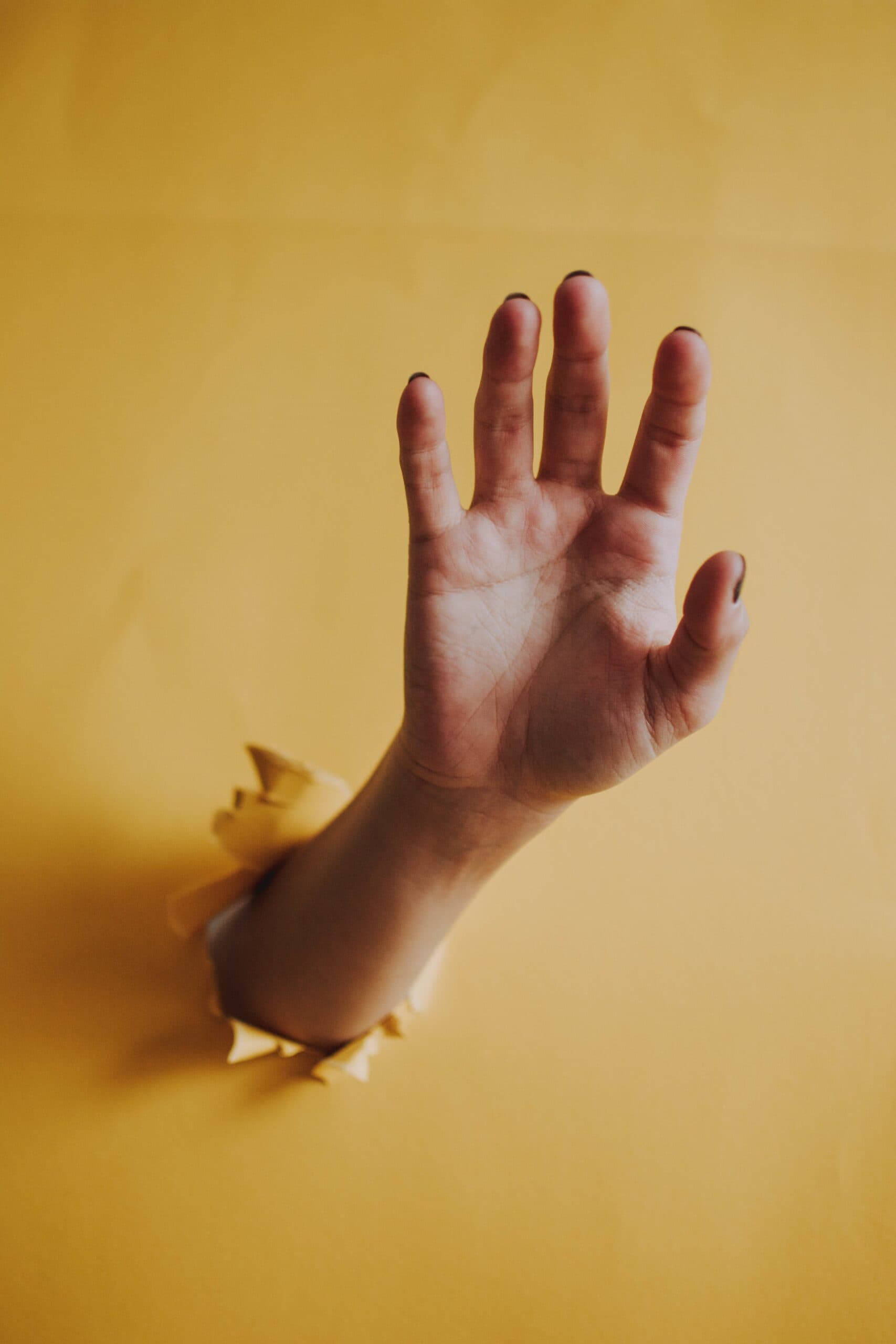 Recovery times after an upper limb fracture: wrist, hand, elbow or shoulder?